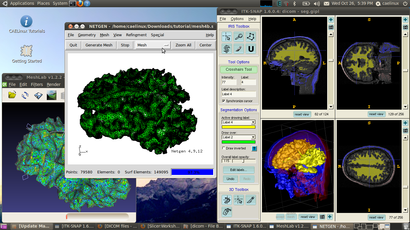 3D biomedical analysis with ITK-Snap, Meshlab, Netgen and VoxelMesher